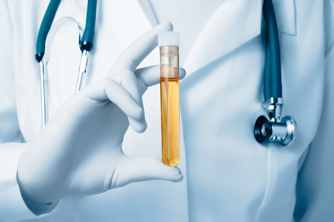 Perangkat Nanowire untuk mendeteksi kanker dengan tes urine