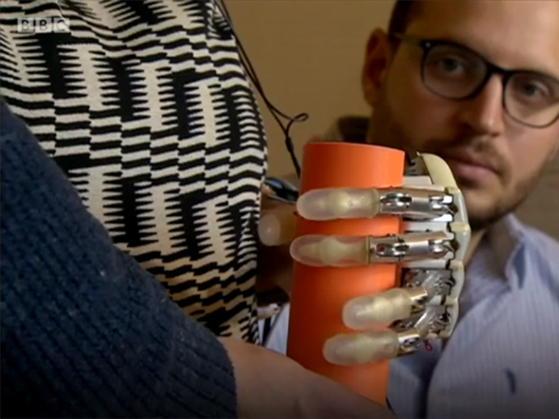 Tangan Robot Bionik